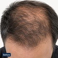 Hair Activation Complex - image 4