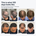 HairGrowth MicroNeedling Solution Serum - image 3