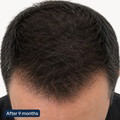 Hair Activation Complex - image 5