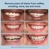 Auraglow Whitening Booster
