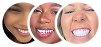 Customers