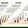 DearRoot™ Clinical Hair Regrowth System
