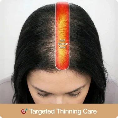 Targeted application