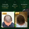 RIZE™ Hair Comb