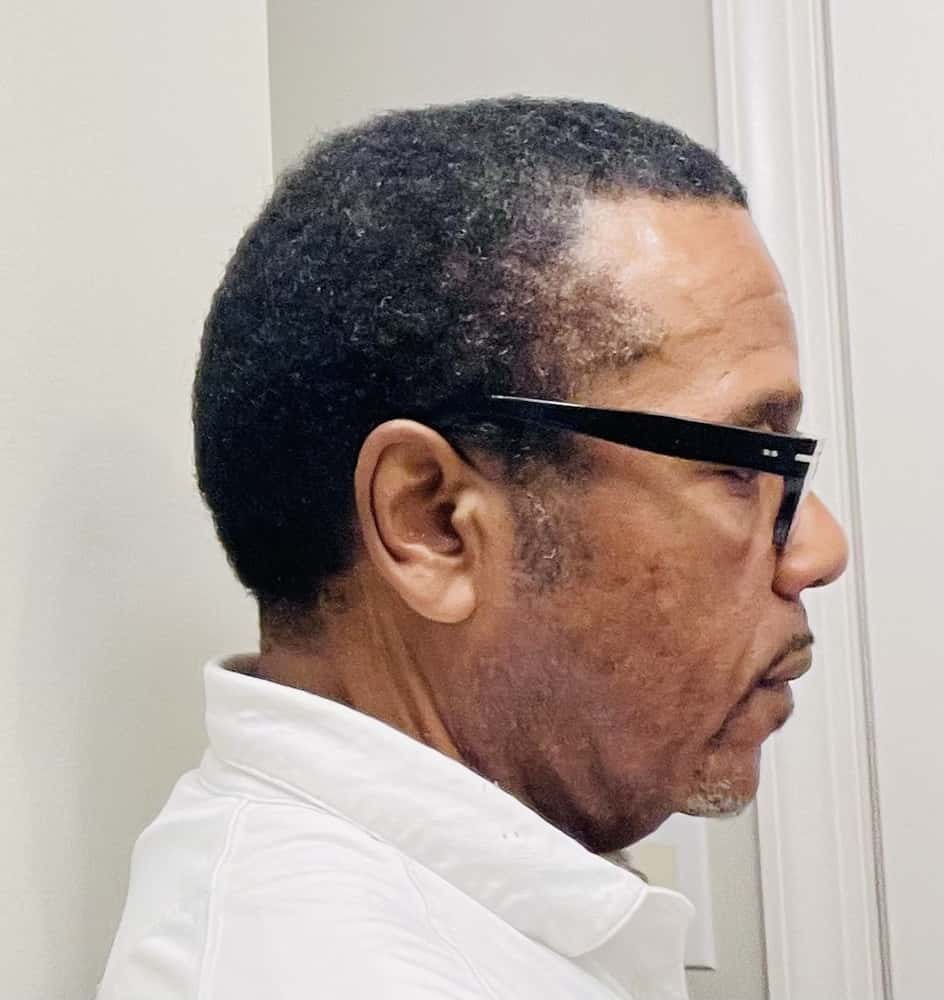 Bernard after using FLEX