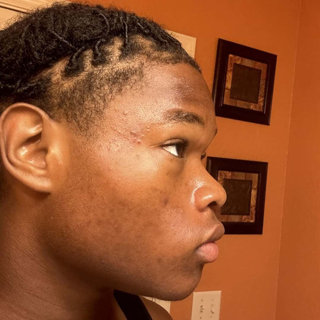 Cameron after using FLEX