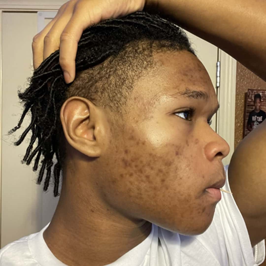 Cameron before using FLEX