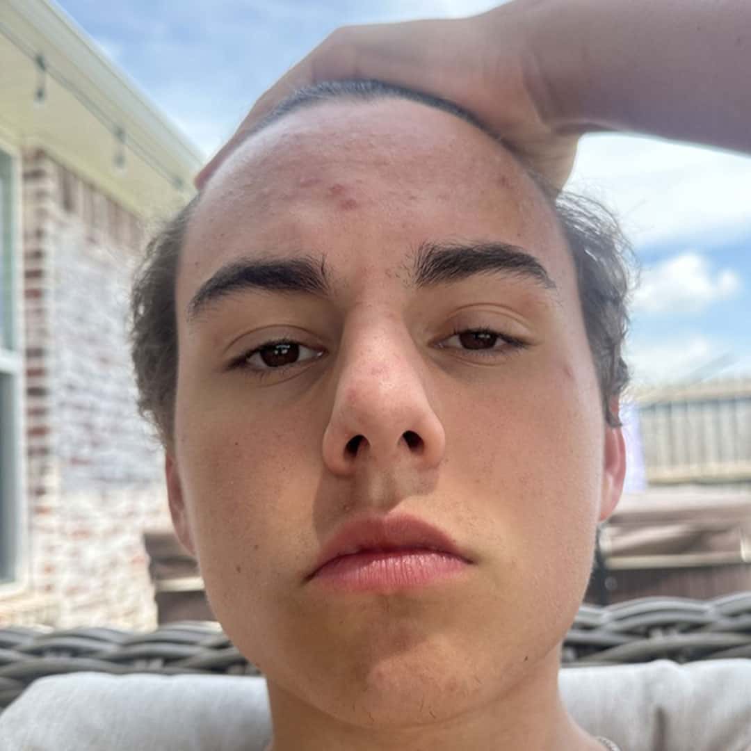 Kadin after using FLEX