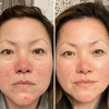 Aphrodite LED Face Mask