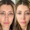 Aphrodite LED Face Mask