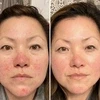 Aphrodite LED Face Mask