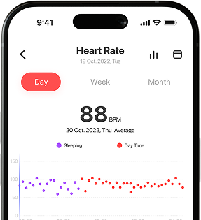Smart Ring Monitoring