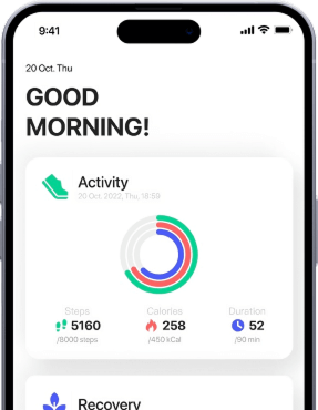 Smart Ring Monitoring