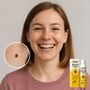 BeeRx Muttermal-Entfernungsspray