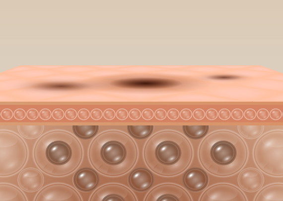 Your Skin’s Hidden Flaw