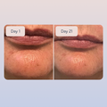 Hyaluronic Serum - image 7