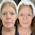 Swiss Niacinamide Serum - image 3