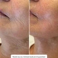 Hyaluronic Serum - image 4