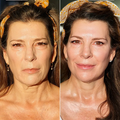 Renewa EyeLift - image 3