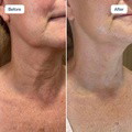 RenewaCell Serum - image 2