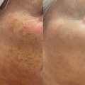 24K Gold Serum - image 2