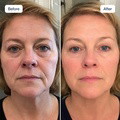 RenewaCell Serum - image 8