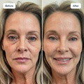 RenewaCell Serum - image 4
