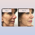 Swiss Niacinamide Serum - image 3