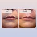 Hyaluronic Serum - image 4