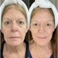 Renewa AgeDefy Serum - image 5