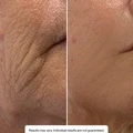 Hyaluronic Serum - image 5