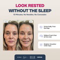 Renewa EyeLift - image 3