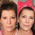 Renewa AgeDefy Serum - image 4