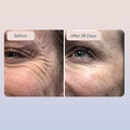 3 Golden Retinol Eye Serum - image 3