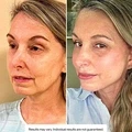 Hyaluronic Serum - image 3