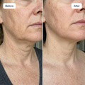 RenewaCell Serum - image 7