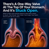 Gut Barrier Repair - Reflux Relief