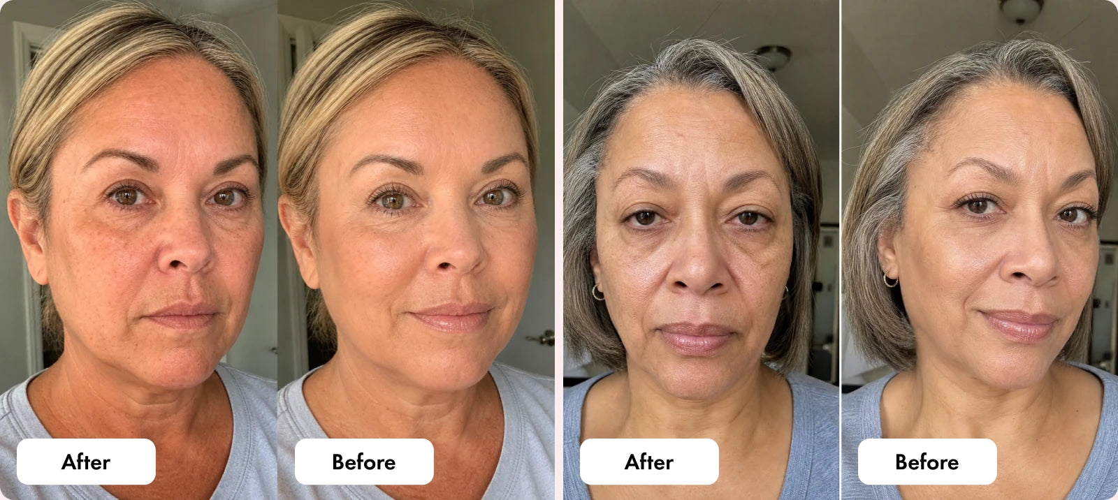 Two before and after comparisons showing smoother skin after use