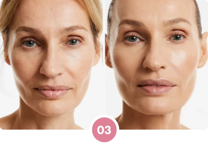 Step 3 - The Perfect Match