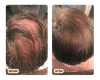 Root Activator Shampoo 2.0 (TEST)
