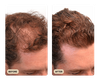 Full Hair Growth System (TEST)