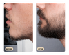 Beard Growth Oil (TEST)