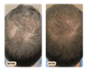 Root Activator Spray (TEST)