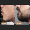 SPARTAN™ - Root Activator Spray & Beard Growth Bundle
