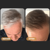 SPARTAN™ - Instant Hair Dye Shampoo