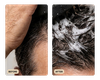 Full Hair Growth System (TEST)