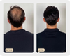 Premium Scalp Brush (TEST)