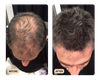 Root Activator Shampoo 2.0 (TEST)