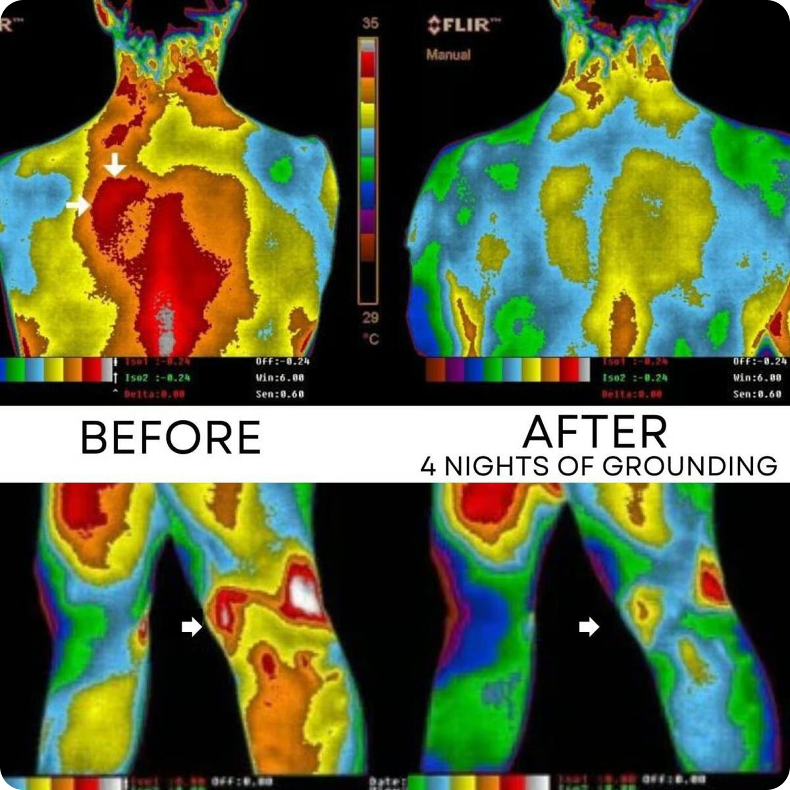 Thermal images of a person's back and legs, labeled 'Before' and 'After' grounding