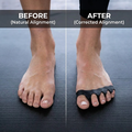 Vibit ALIGN Toe Spacers - image 4